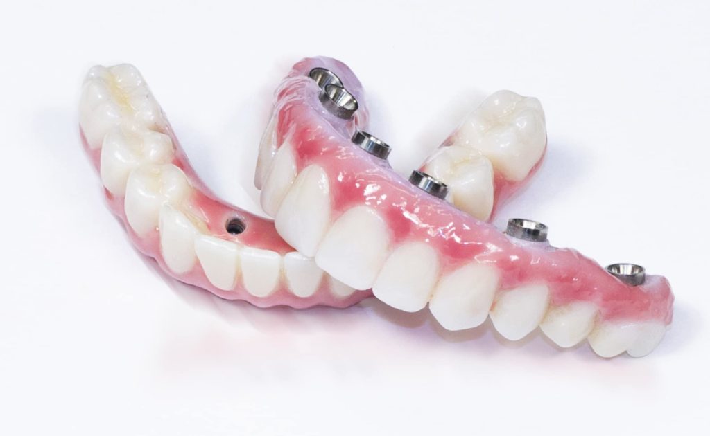 Dental Implants Orlando Same Day Procedure New Teeth Now