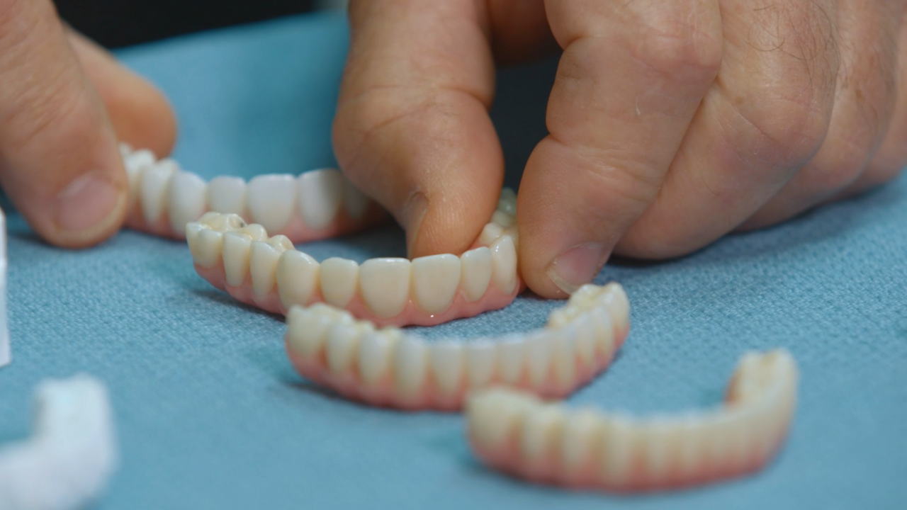 Examples of superior quality of zirconia set side-by-side with the less durable acrylic teeth