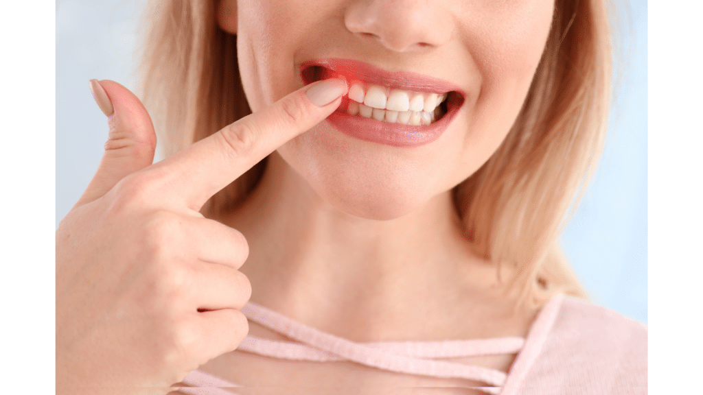 periodontal disease